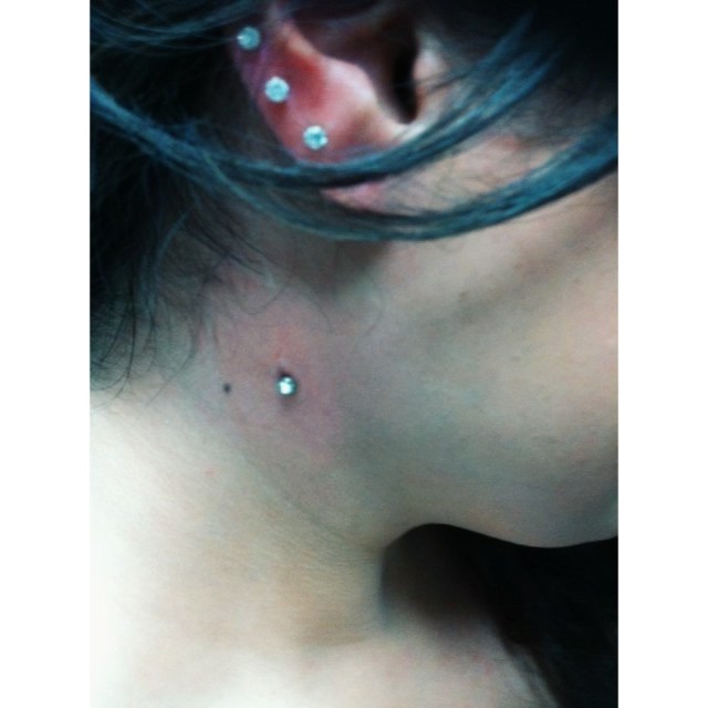 Neck Micro Dermal Anchor