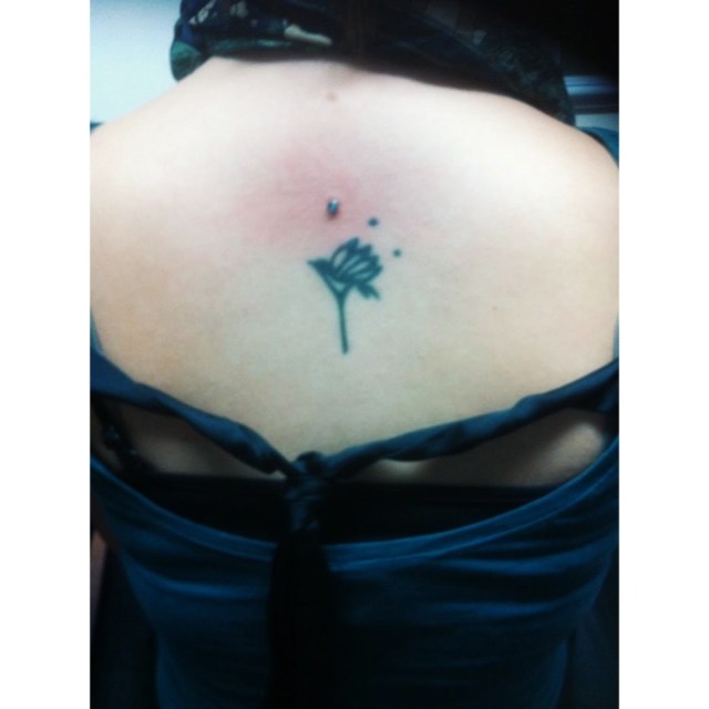 Back Dermal Anchor I