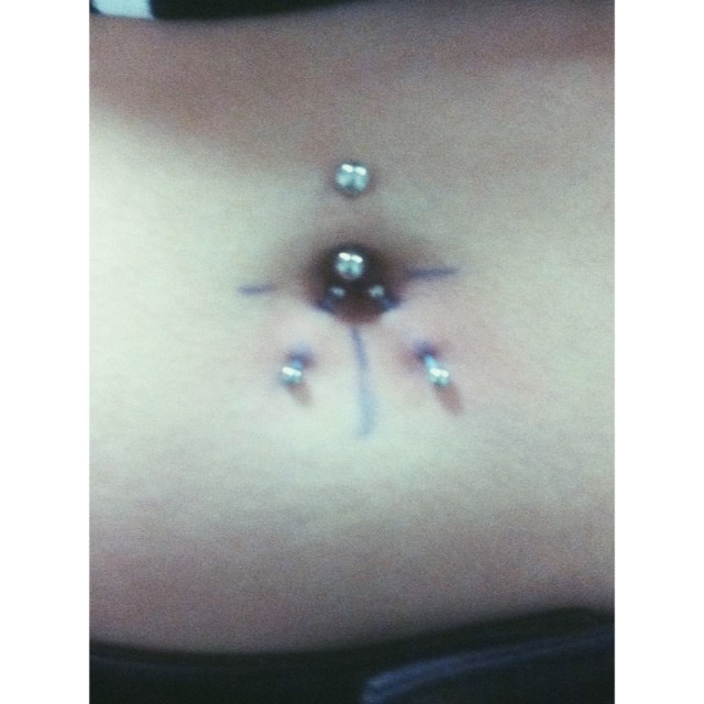 Surface Navel Piercings w/PTFE.