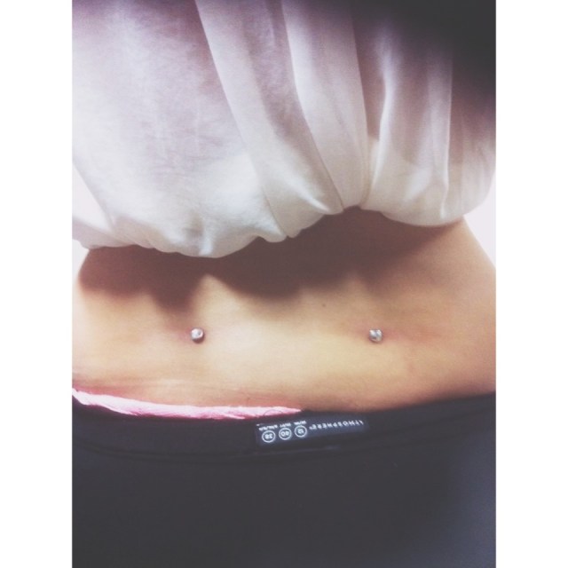 Back Dimple Dermals.