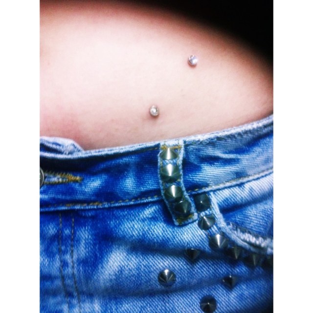 Hip Dermal Anchors