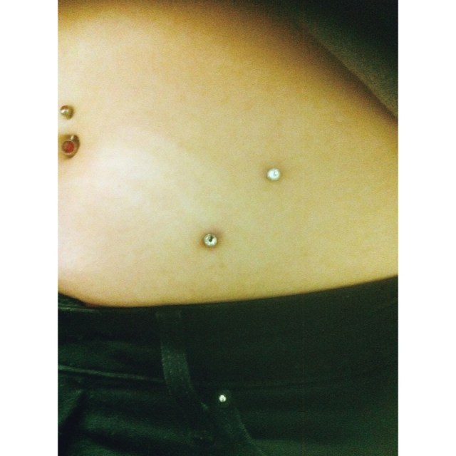 Hip Dermals