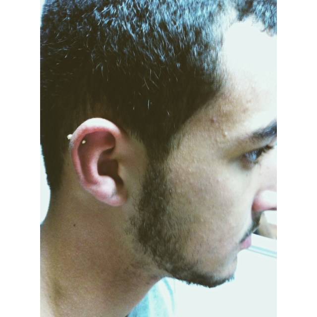 Top Ear w/gold titanium