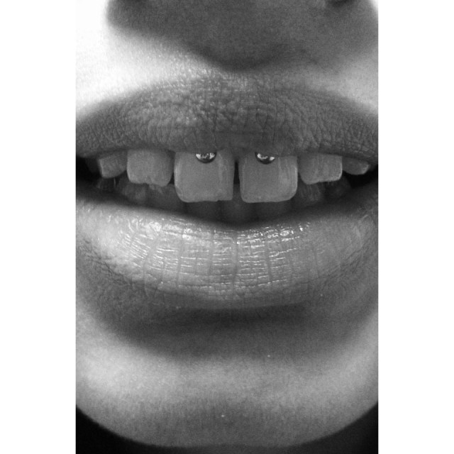 Smiley Piercing