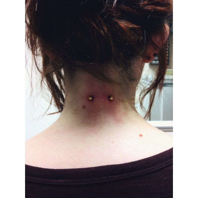 Nape Surface Piercing