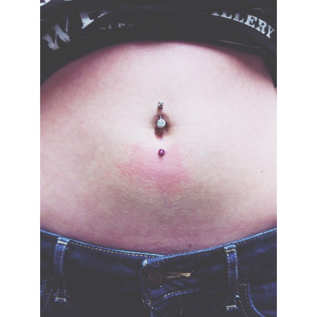 Navel Dermal