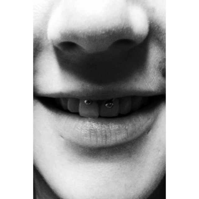 Smiley Piercing