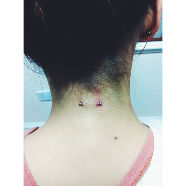 Nape Surface w/1.2mm PTFE