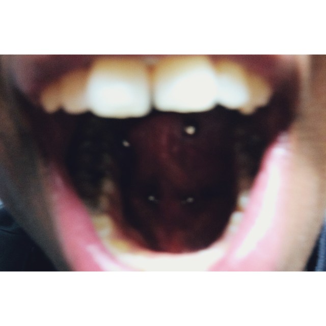 Shanice's Tongue-Web Piercing