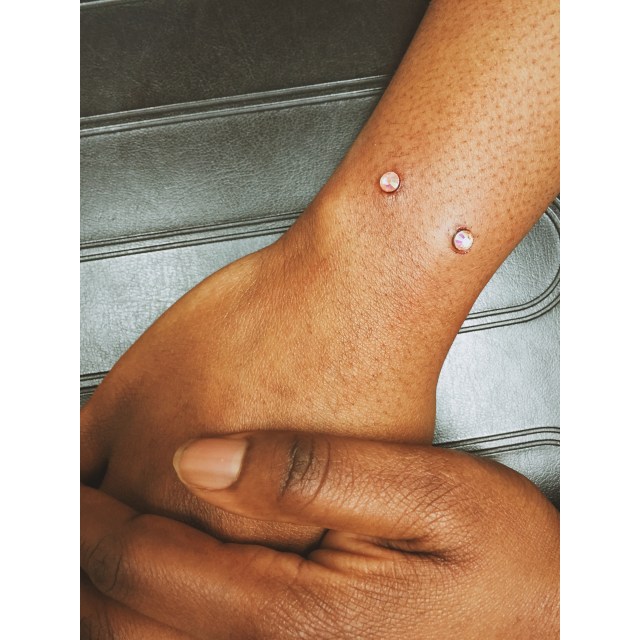 Natesha's Wrist Dermals