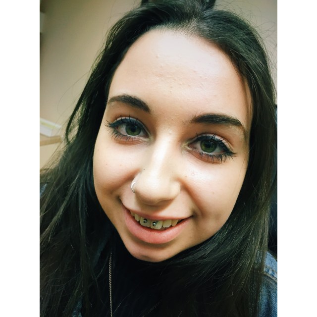 Erin's Smiley Piercing