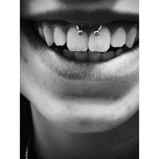 Erin's Smiley w/6mm CBB.