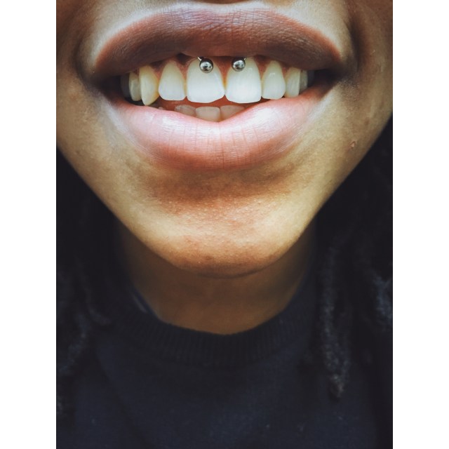 Dana's Smiley Piercing