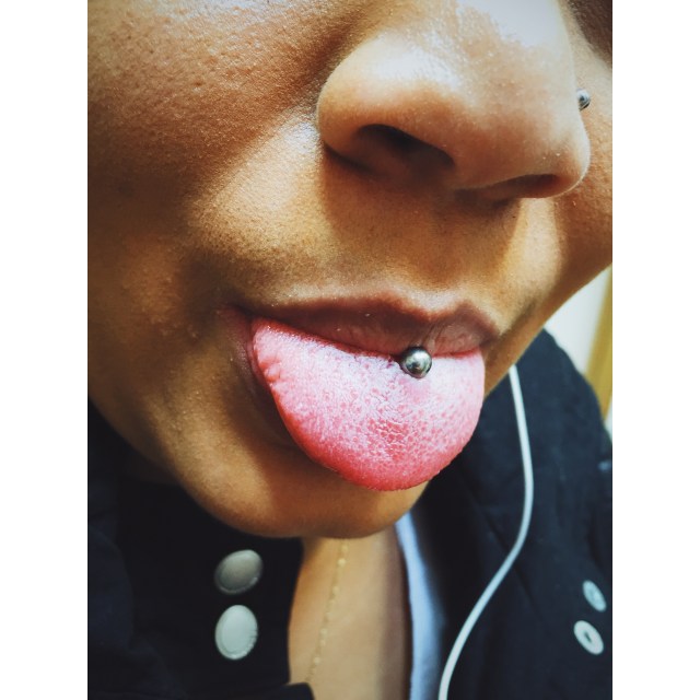 Tongue