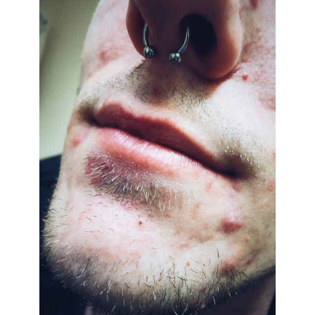 Tom's Septum Piercing