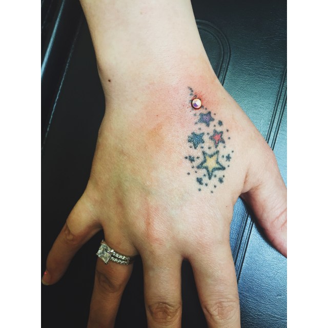 Rebecca's Hand Dermal I
