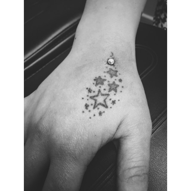 Rebecca's Hand Dermal II
