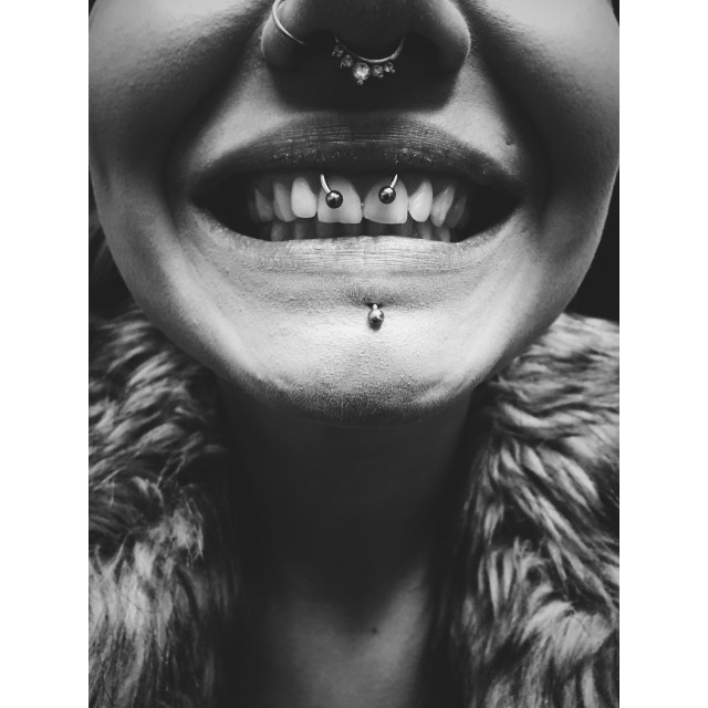 Upper Lip Frenulum Piercing
